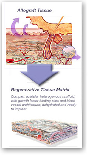 alloderm tissue